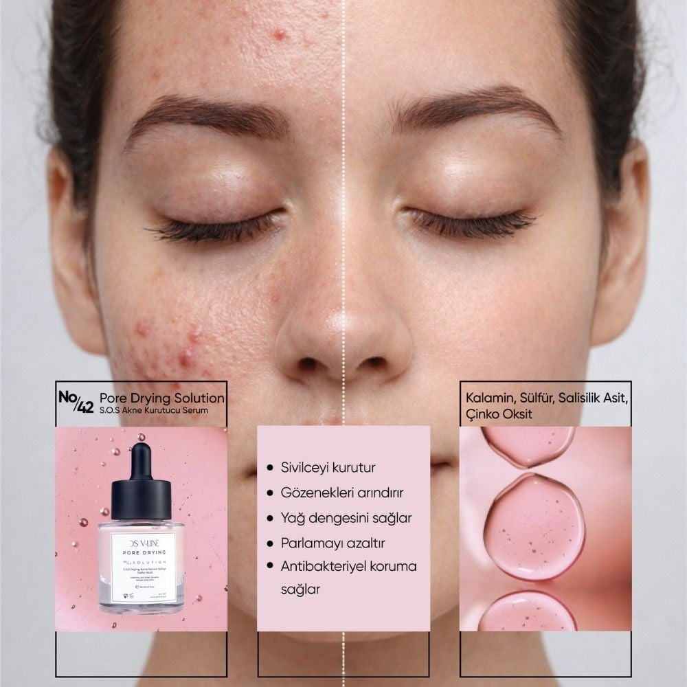 42 Sebum Balancing Sulfur Serum