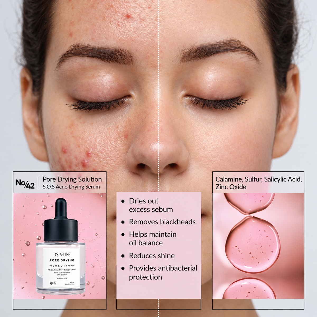 42 Talgregulierendes Schwefel-Serum
